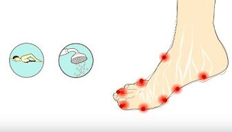 Causes of mushrooms on the toes