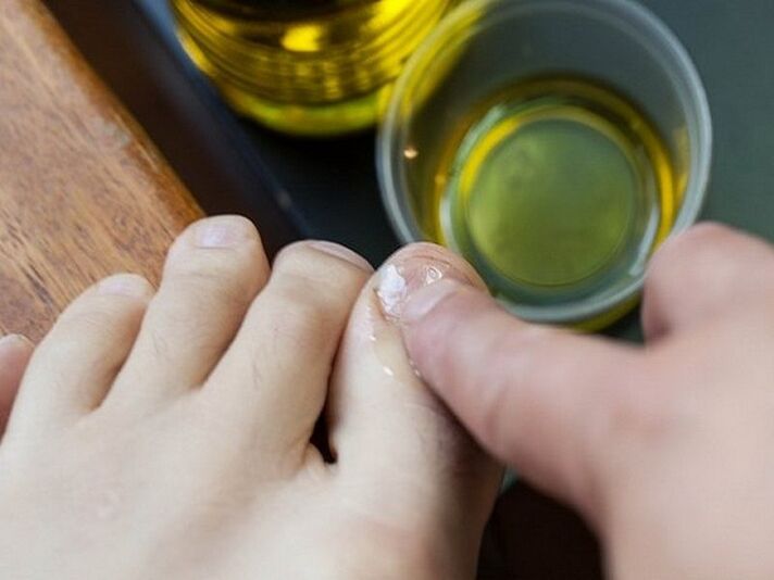 Application of medicated oil to nails affected by fungus