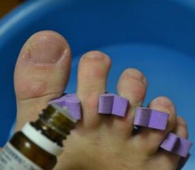 Preparation for nail treatment with antifungal drops